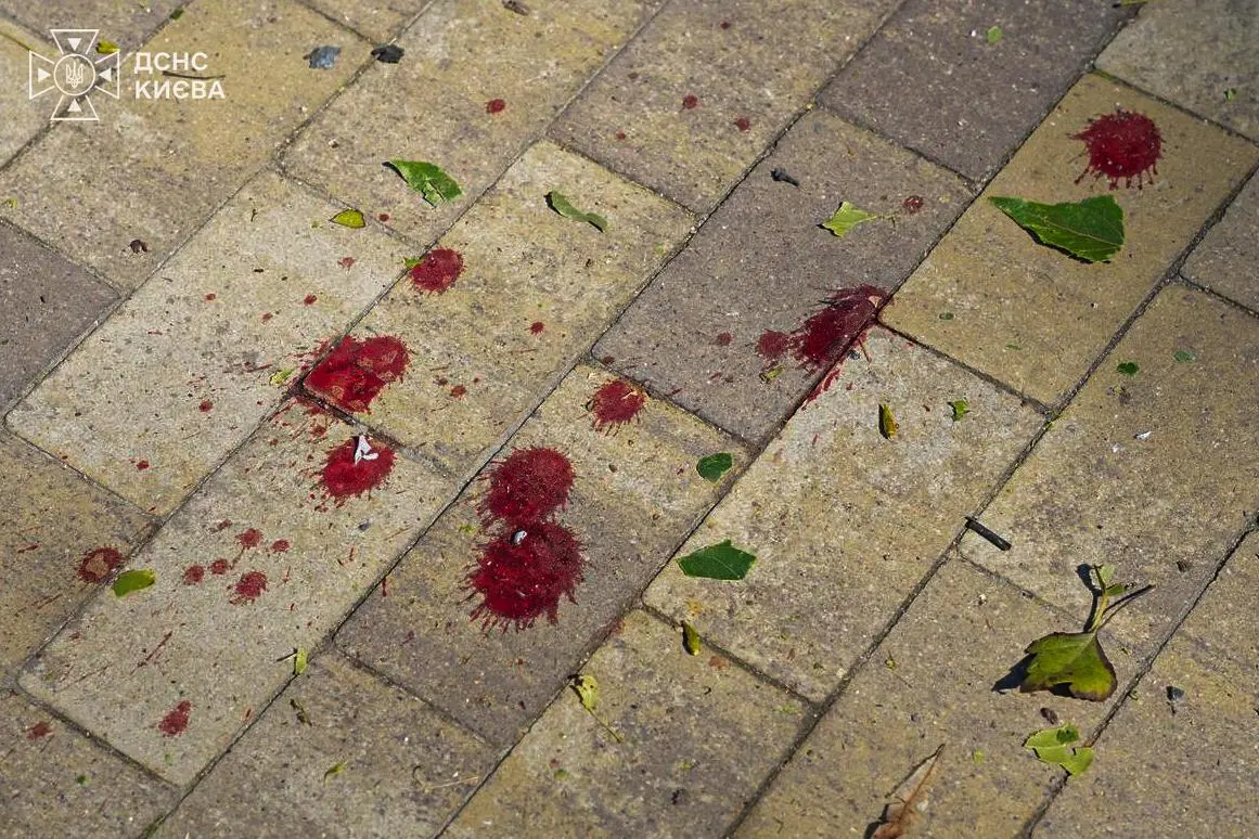 У Києві через російську атаку загинула 2-річна дитина, ще 2 людей — постраждали