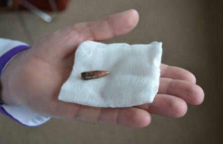 У Дніпропетровській лікарні імені Мечникова врятували пораненого бійця