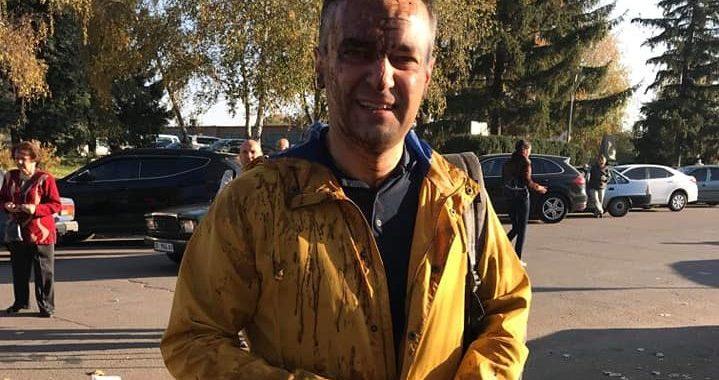 Поліція знайшла людей, які облили політика Гнапа нечистотами
