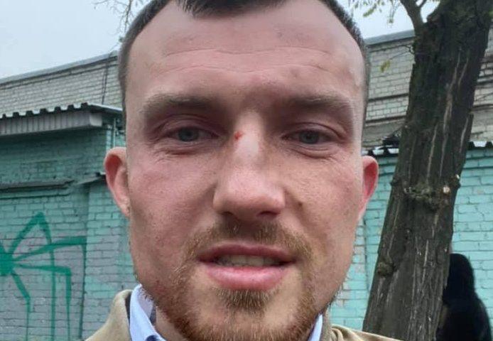 Засновник StateWatch Лємєнов повідомив про напад на нього