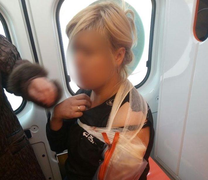 У Мар’їнці бойовики зі стрілецької зброї поранили жінку — штаб ООС