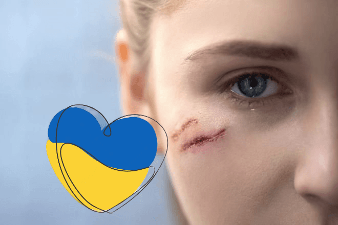 Лікарі об’єдналися заради допомоги під час війни: корекція шрамів травматичних уражень шкіри